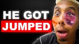 Johnny Somali Finally Got Punished..