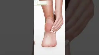 Откуда берутся трещины на пятках, и как от них избавиться