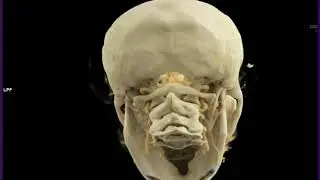 C-Spine with Cinematic Rendering