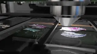 Abbott Animation Medical Reel