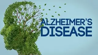 Alzheimers Disease