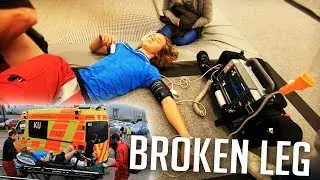 Bad Trampoline ACCIDENT leads to Broken leg  *GRAPHIC*