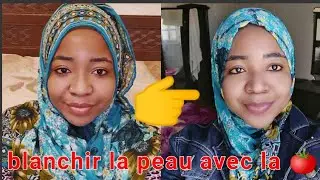 comment blanchir sa peau naturellement ?🍅