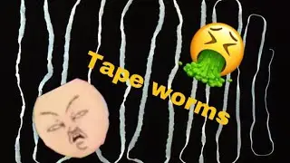 Reacting To Untold Stories Of The ER (SASSY Mother Gives Tape Worms To Daughter)