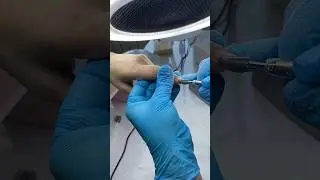 Как работает вытяжка 4Blanc 