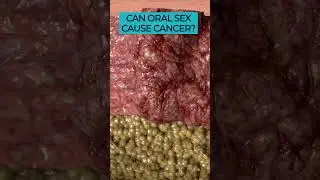 Understanding the Connection Between Oral Sex, HPV, and Cancer 🎗️💋🦠 