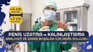 P3nis Uzatma (+2 cm)  ve Kalınlaştırma (+4 cm) Ameliyatı ve Erken Boşalma için P3nis Dolgusu
