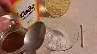 How to quickly cure sinusitis at home. 100% cure