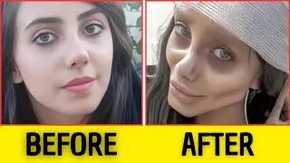 TOO MUCH SURGERY? 40+ CELEBRITIES WHO TOOK IT TOO FAR | BEFORE & AFTER 2025