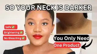 HOW TO TREAT AND GET RID OF DARK NECK & HYPERPIGMENTATION PERMANENTLY FOR A BRIGHT AN EVEN SKIN-TONE