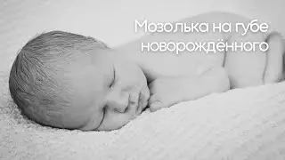 Мозолька на губе