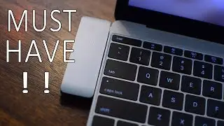 Top 8 Must Have Macbook Accesories for 2017!