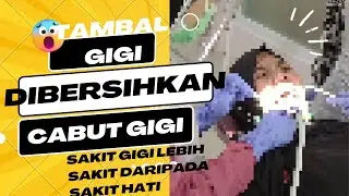 proses tambal gigi, dibersihkan dulu, ditambal, cabut gigi