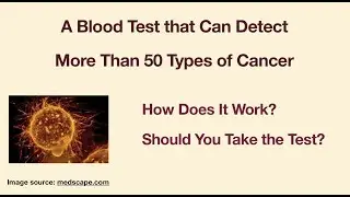 A blood test that provides early detection of cancers