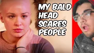 Dumb Girl Gets Dumped For Being Bald