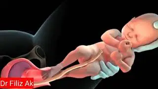 Vaginal Normal Dogùm