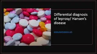 Medical Zone - Differential diagnosis of leprosy: Hansen’s disease