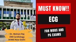 The Most Critical ECGs Every Doctor Should Recognize