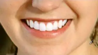 Blanquear Dientes en Photoshop