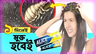 উকুন দূর করার উপায় | ১ দিনেই মুক্ত হবে উকুন