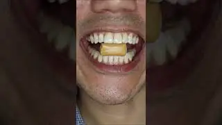 ASMR | Hi Chew Soda Pop - See more Hi Chew here 👇