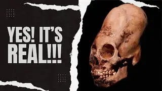 Ancient Skull-Shaping Secrets Revealed! #ancienthistory  #historyinpictures #trarcade