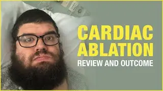 The Cardiac Ablation Procedure Review and Outcome