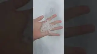Аланию засыпало градом.