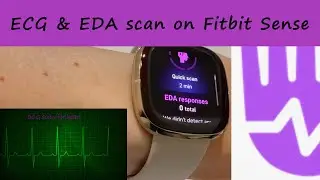 EDA and ECG scan on the Fitbit Sense after one week of use.