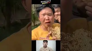 A man has been bitten by a bee🐝👀😱#shorts