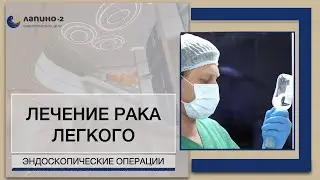 Лечение рака легких: эндоскопический метод.