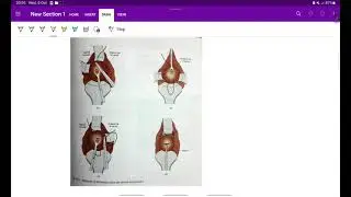 Cervical incompetence | Obstetrics | OG | Easy notes | MeDTecH29