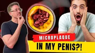 Penile Blood Flow Problems - Vascular Erectile Dysfunction Symptoms, Micro Plaque ED, & The Phoenix!