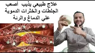 علاج اصعب الجلطات والوقاية منها وتسريح مجري الدم من تكتل الكلسترول وخترات الدم