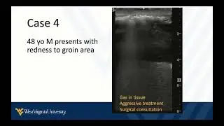 POCUS in Skin and Soft Tissue Infections 3 - Summary, Review, Pitfalls