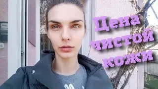 Никогда не принимайте Акнекутан (Роаккутан) не посмотрев это видео. Жесткая плата за чистую кожу