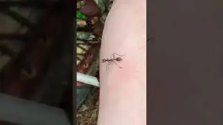 First Aid for Ant Bites 