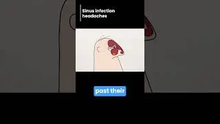 Sinus infection : headaches | #shorts