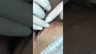 Ін'єкції краси