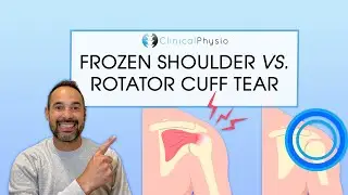 What is the Difference Between Frozen Shoulder And Rotator Cuff Tear? | Expert Physio Guide