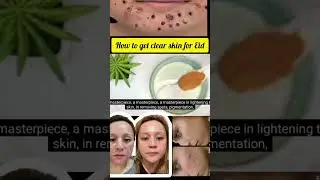 #Eid Series#How to get clear skin at Home For Eid#shorts#viral#beauty#ramzan