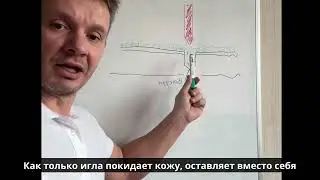 Как работает микрониллинг: сыворотка под кожу | Подписывайтесь на канал для успешных косметологов!