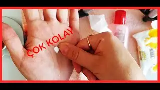 2 FARKLI YÖNTEMLE ÇOK KOLAY FRENCH TAKTİĞİ KUSURSUZ !!!