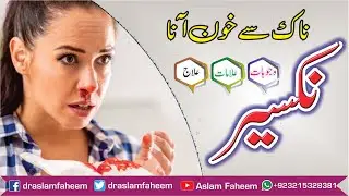Epistaxis, Causes, Sign Symptoms & Treatment | Nakseer ki waja aur Ilaj | Nose bleeding Treatment