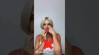 Nasolabia Folds | Getting Rid of Them | Don't Inject Them