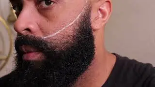 How to Raise the Beard Cheek-Line | Week 5 update