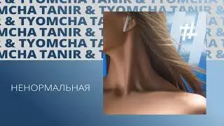 Tanir & Tyomcha - Ненормальная