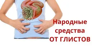 Как избавиться от глистов в домашних условиях