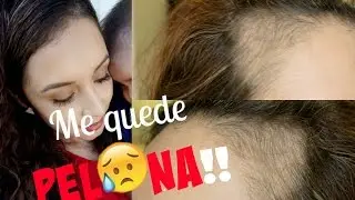 SE ME CAYO EL CABELLO - DEPRESIÓN - REMEDIOS