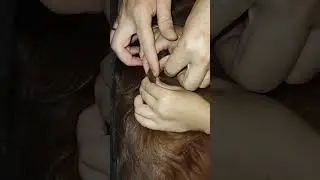 Как вытащить клеща у собаки.